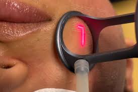 Is Laser Technician a Good Career in Canada? 2026 Guide